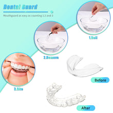 Load image into Gallery viewer, Mold able Dental Guard
